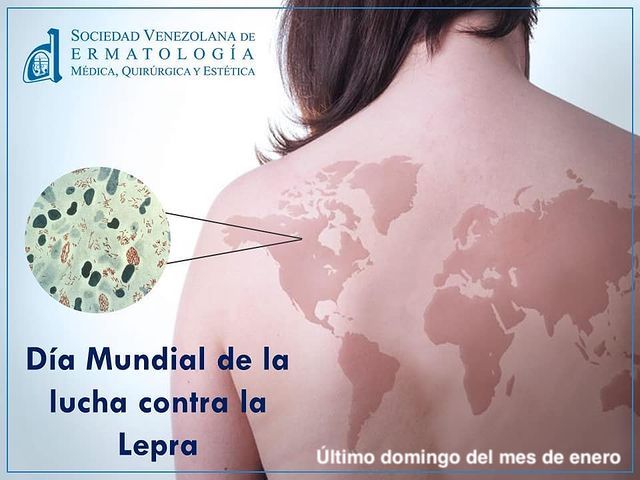 Fecha importante 1