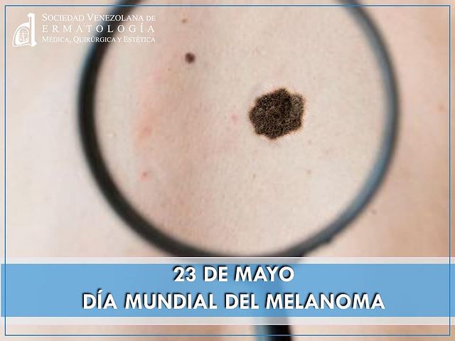 Fecha importante 2