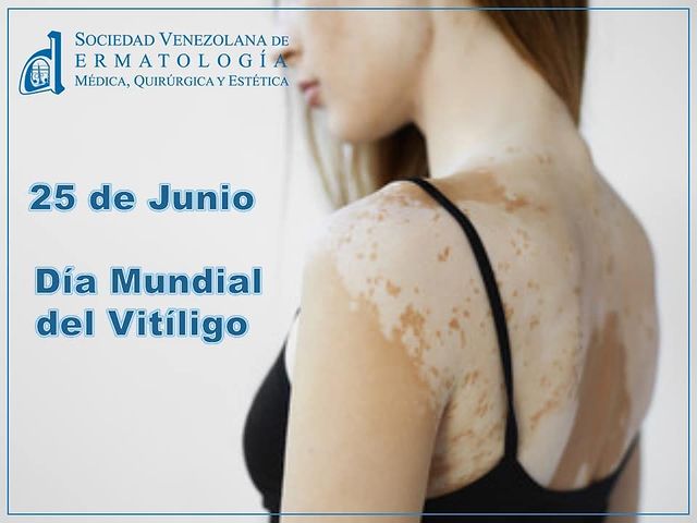Fecha importante 3