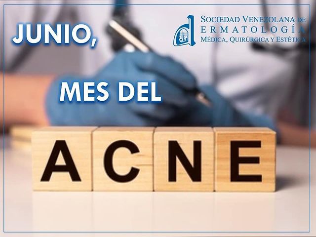 Fecha importante 4