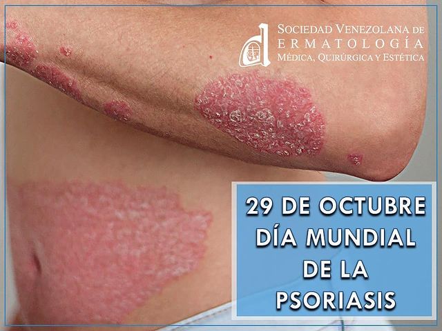 Fecha importante 5