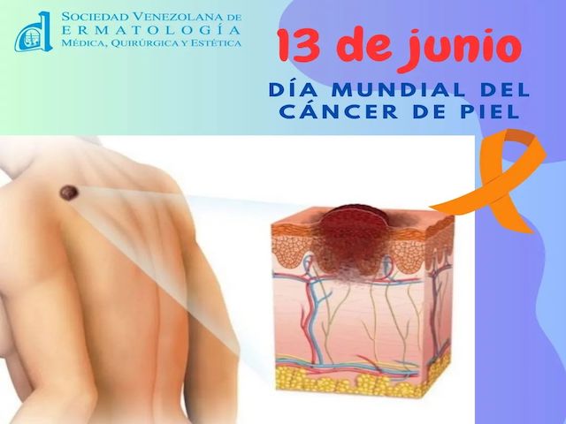 Fecha importante 7